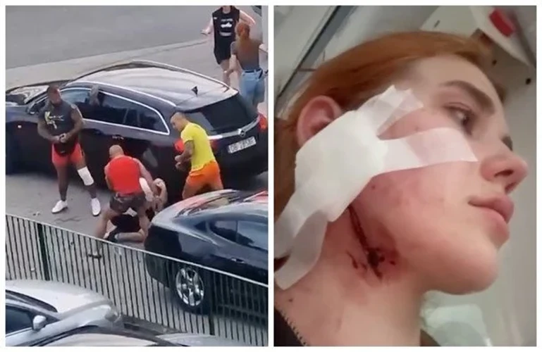 Карина Кіцай розповіла про побиття доньки та її хлопця у Польщі