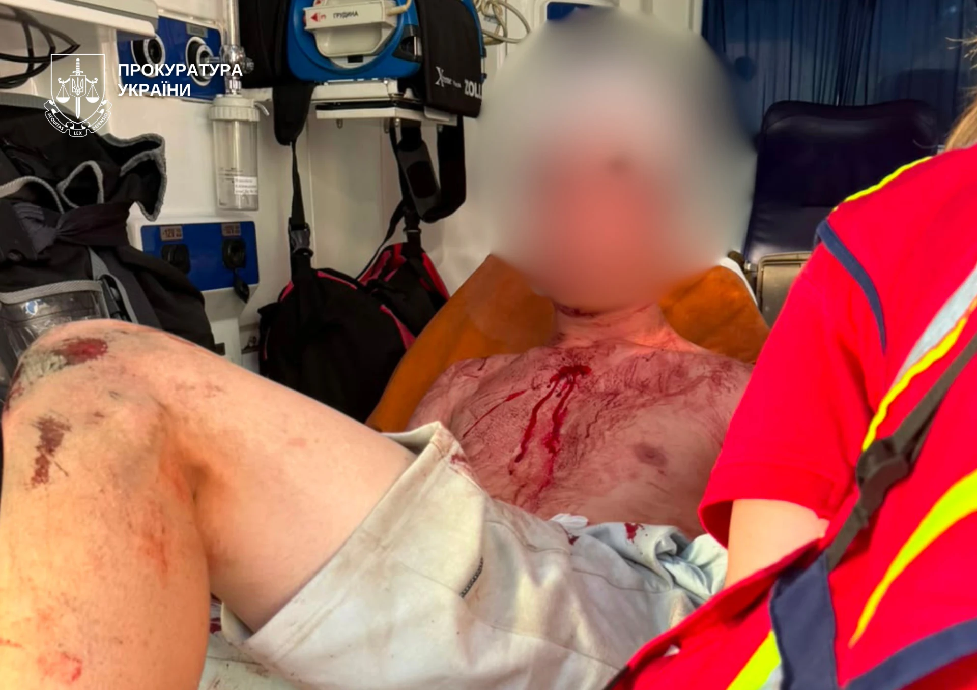 У Києві оголосили підозру 19-річному студенту за напад з ножем на трьох чоловіків